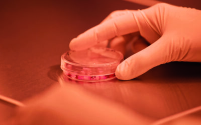 Crianças com paralisia cerebral melhoram após tratamento com sangue do cordão umbilical de um irmão