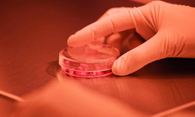 Crianças com paralisia cerebral melhoram após tratamento com sangue do cordão umbilical de um irmão
